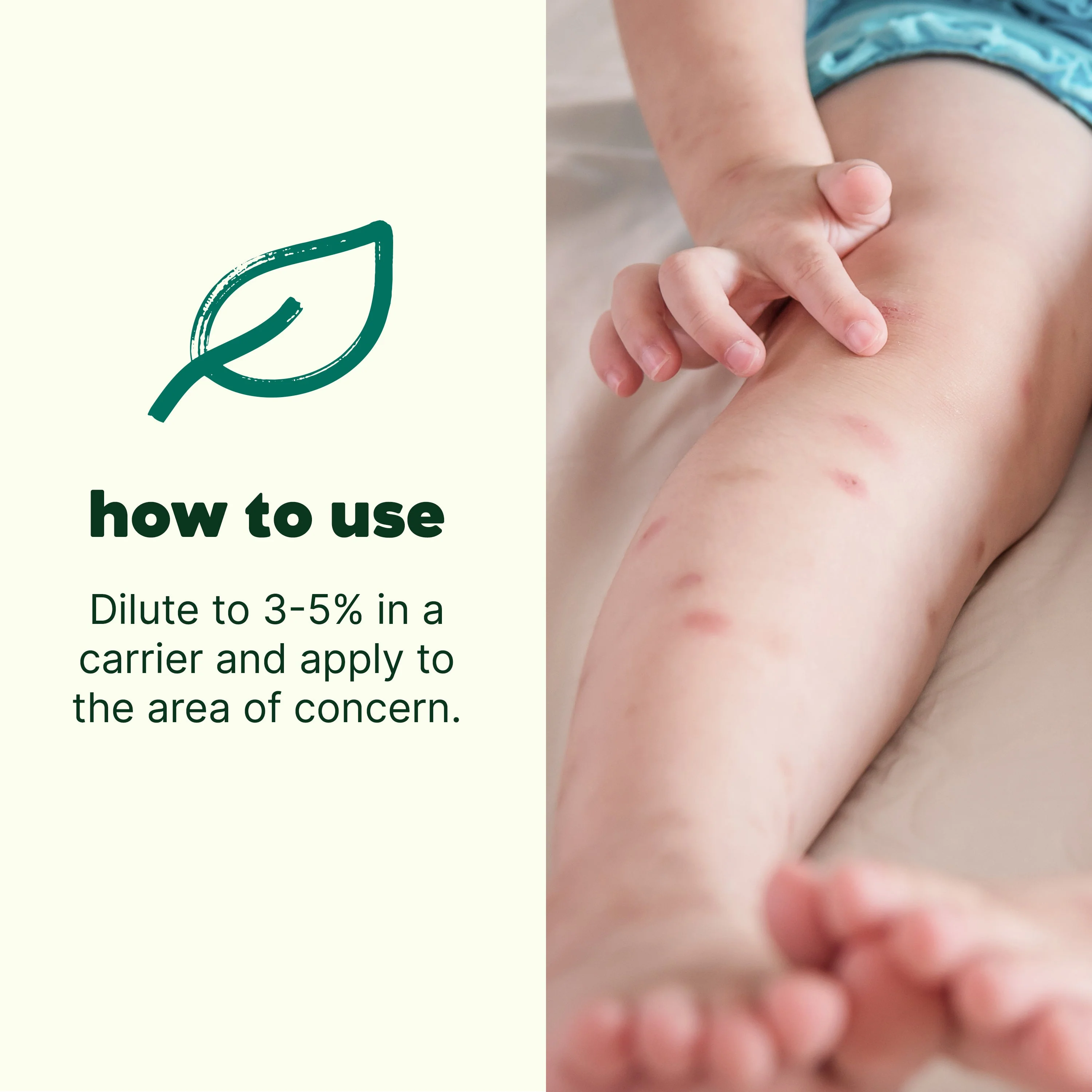 Itch Away Essential Oil - Image 3
