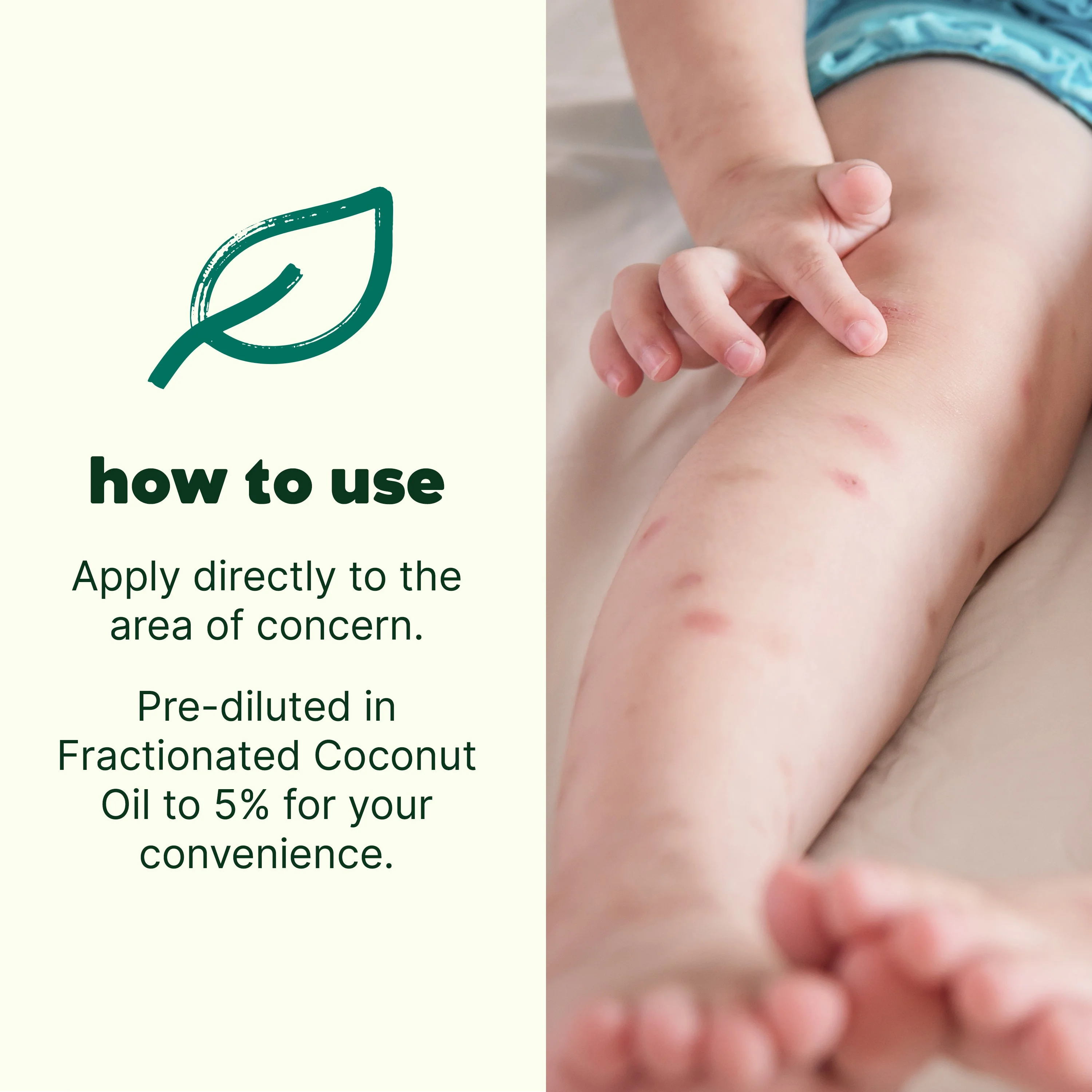 Itch Away Essential Oil Pre-Diluted Roll-On - Image 4